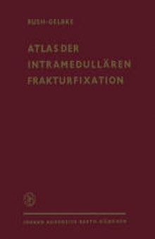 Atlas der Intramedullären Frakturfixation nach Rush: Ein Behandlungssystem