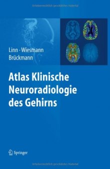 Atlas Klinische Neuroradiologie des Gehirns  