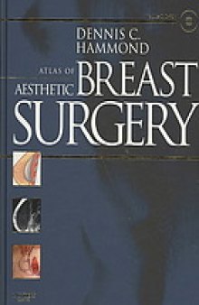 Atlas of aesthetic breast surgery