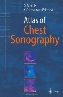 Atlas of Chest Sonography
