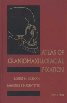 Atlas of Craniomaxillofacial Fixation