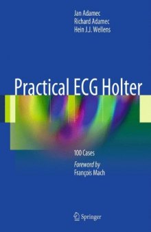 Practical ECG Holter: 100 Cases