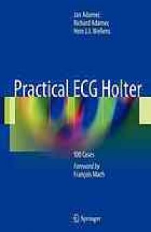 Practical ECG Holter: 100 Cases