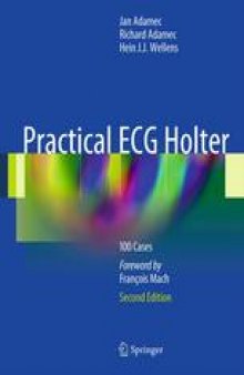 Practical ECG Holter: 100 Cases