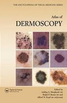 Atlas of dermoscopy