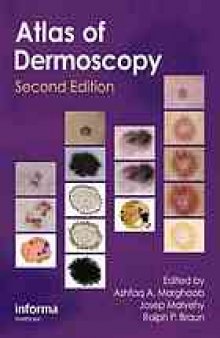 Atlas of dermoscopy