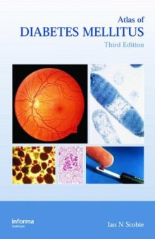 Atlas of Diabetes Mellitus