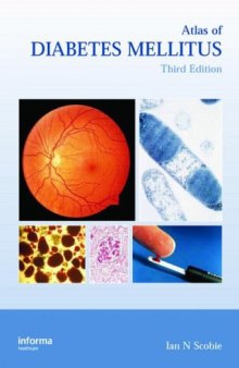 Atlas of Diabetes Mellitus, Third Edition (Encyclopedia of Visual Medicine)