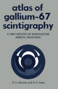 Atlas of Gallium-67 Scintigraphy: A New Method of Radionuclide Medical Diagnosis