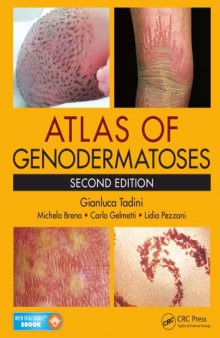 Atlas of genodermatoses