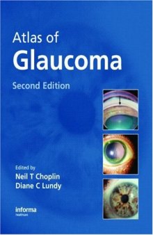 Atlas of Glaucoma, Second Edition