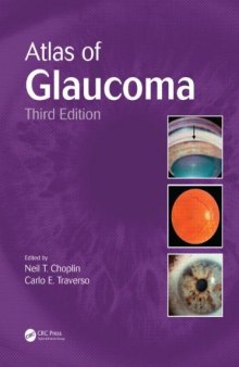 Atlas of Glaucoma, Third Edition