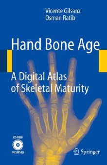 Atlas of Hand Bone Age