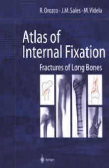 Atlas of Internal Fixation: Fractures of Long Bones. Classification, Statistical Analysis, Technique, Radiology