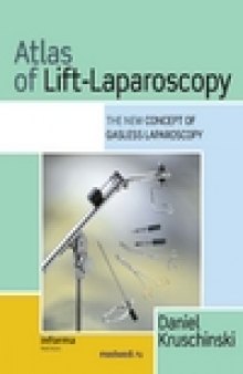 Atlas of Lift-Laparoscopy: The New Concept of Gasless Laparoscopy