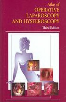 Atlas of operative laparoscopy and hysteroscopy