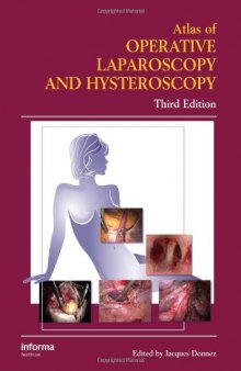 Atlas of Operative Laparoscopy and Hysteroscopy, Third Edition