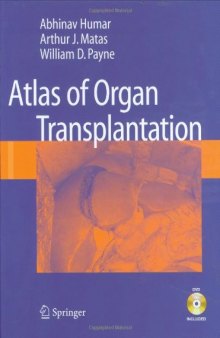 Atlas of Organ Transplantation