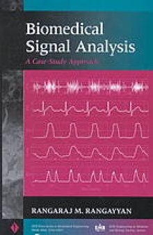 Biomedical signal analysis : a case-study approach