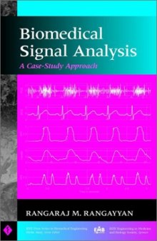 Biomedical Signal Analysis: A Case-Study Approach (IEEE Press Series on Biomedical Engineering)
