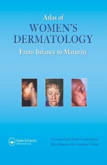 Atlas of Women's Dermatology: From Infancy to Maturity