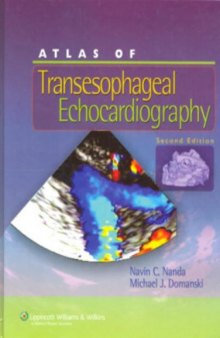 Atlas of Transesophageal Echocardiography