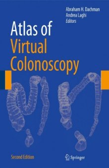 Atlas of Virtual Colonoscopy: Comprehensive Atlas and Fundamentals