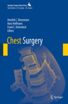 Chest Surgery