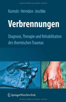 Verbrennungen: Diagnose, Therapie und Rehabilitation des thermischen Traumas 