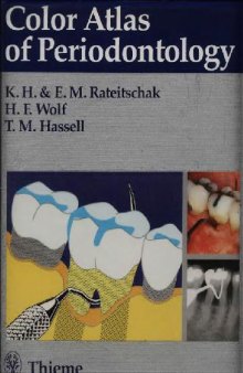 Color Atlas of Dental Medicine Periodontology