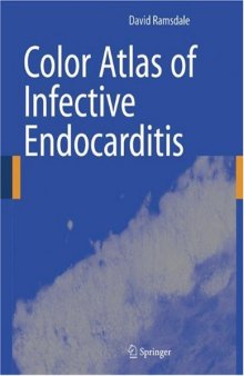 Color atlas of infective endocarditis