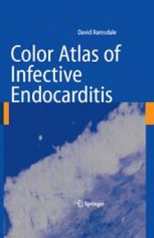 Color Atlas of Infective Endocarditis