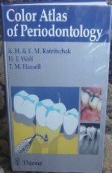 Color atlas of periodontology