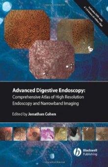 Comprehensive Atlas of High Resolution Endoscopy and Narrowband Imaging