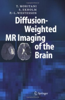 Diffusion-Weighted MR Imaging of the Brain 1st ed (2005)