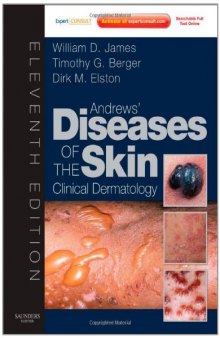 Andrews' Diseases of the Skin: Clinical Dermatology - Expert Consult - Online and Print (James, Andrew's Disease of the Skin), 11th Edition  