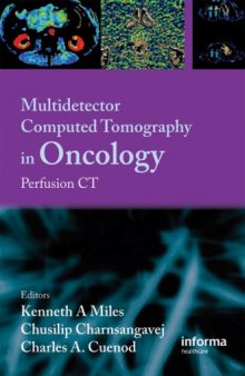 Multi-Detector Computed Tomography in Oncology: CT Perfusion Imaging