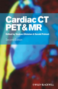 Cardiac Mapping, Third Edition