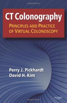 CT Colonography: Principles and Practice of Virtual Colonoscopy
