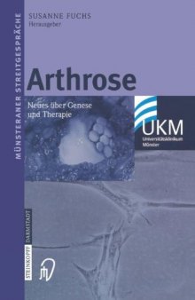 Arthrose: Neues über Genese und Therapie