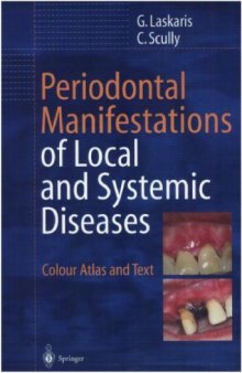 Periodontal Manifestations of Local and Systemic Diseases: Colour Atlas and Text