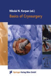 Basics of Cryosurgery