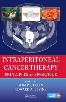 Intraperitoneal cancer therapy : principles and practice