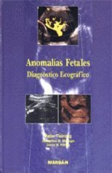 Anomalías fetales: diagnóstico ecográfico
