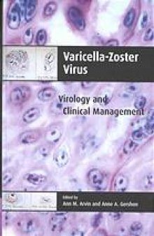 Varicella-zoster virus : virology and clinical management