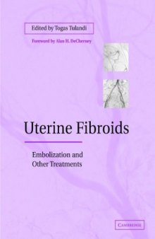 Uterine Fibroids: Embolization and other Treatments