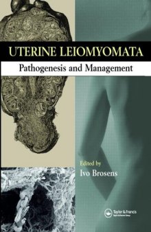 Uterine Leiomyomas: Pathogenesis and Management