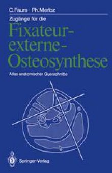 Zugänge für die Fixateur-externe-Osteosynthese: Atlas anatomischer Querschnitte