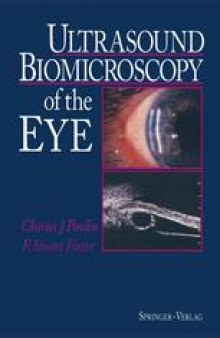 Ultrasound Biomicroscopy of the Eye