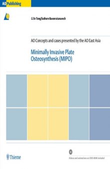 Minimally Invasive Plate Osteosynthesis (MIPO)  